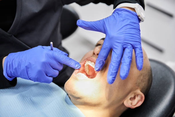 Best Emergency Treatment for Dental Infections or Abscesses in Ladonia, AL